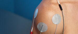 Interferential Current Therapy (IFC) in Burlington